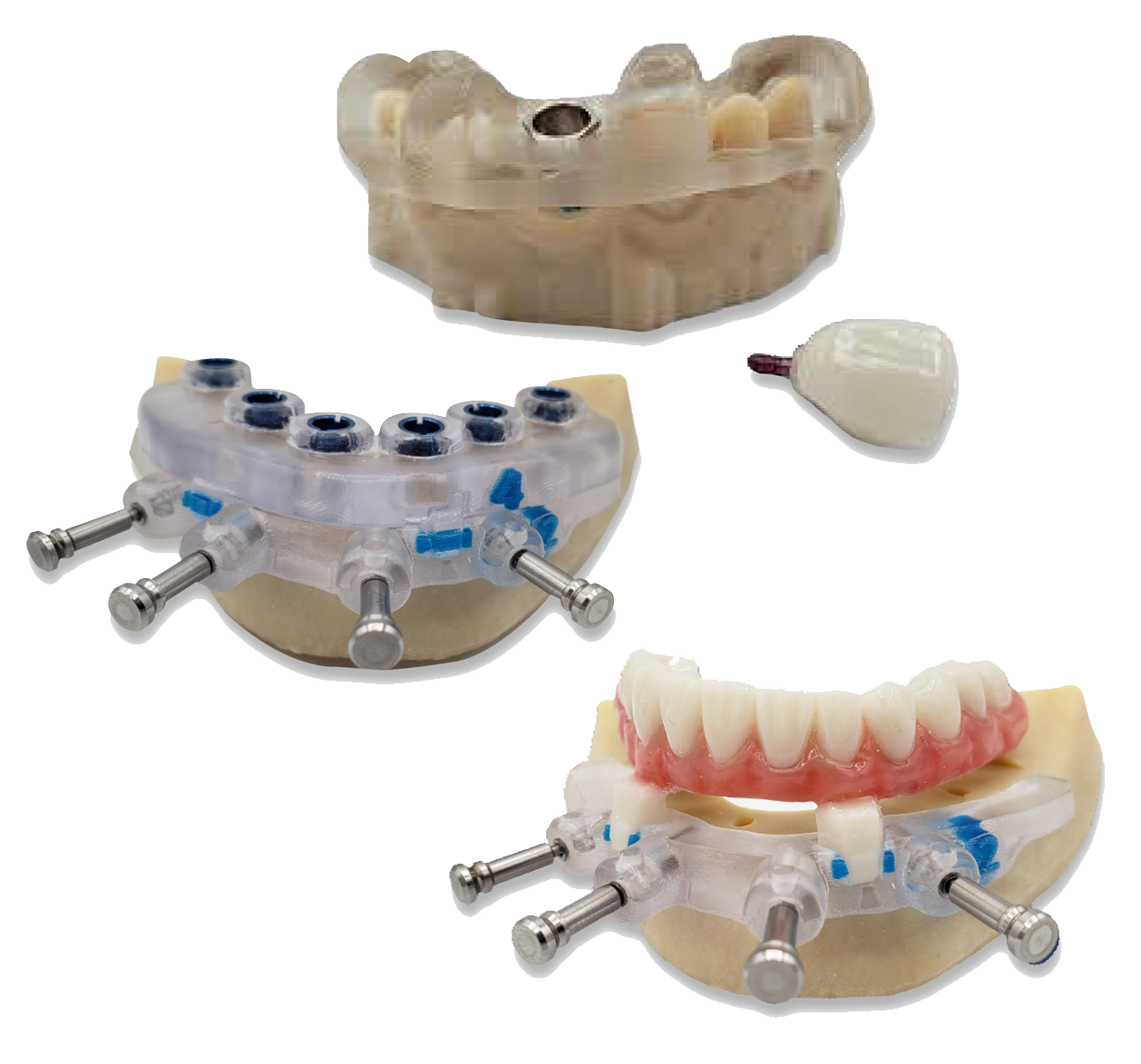 Implant Concierge Guided Surgery Models